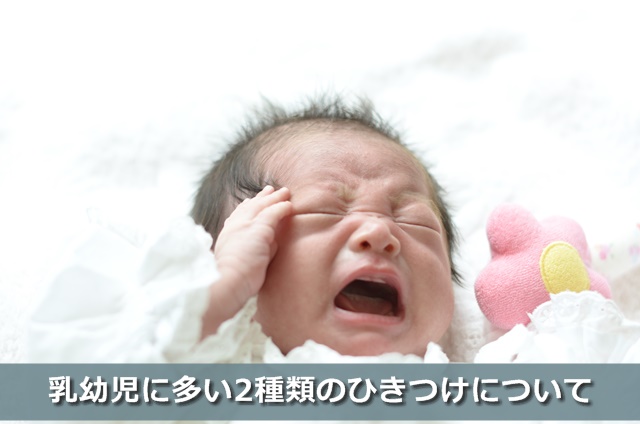 ひきつけをしている赤ちゃん