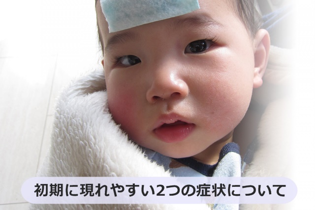 熱を出している赤ちゃん